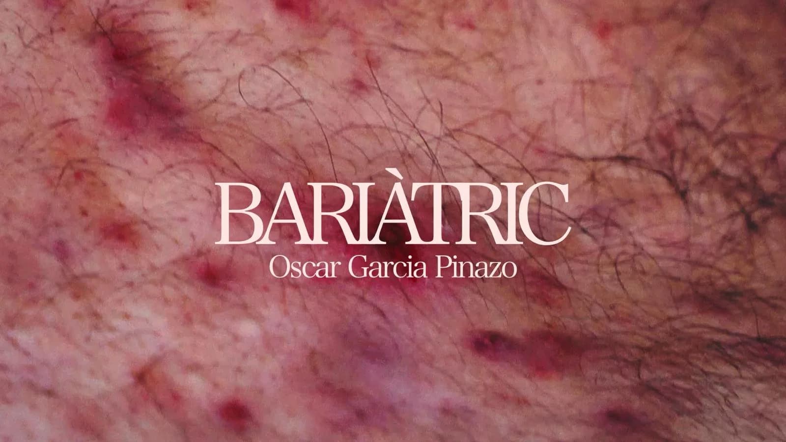 Bariàtric